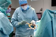 The milestone transplant was performed at Skåne University Hospital in February