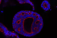 3D pancreatic organoids stained DAPI (blue-nucleus) and phalloidin to stain F-Actin in red